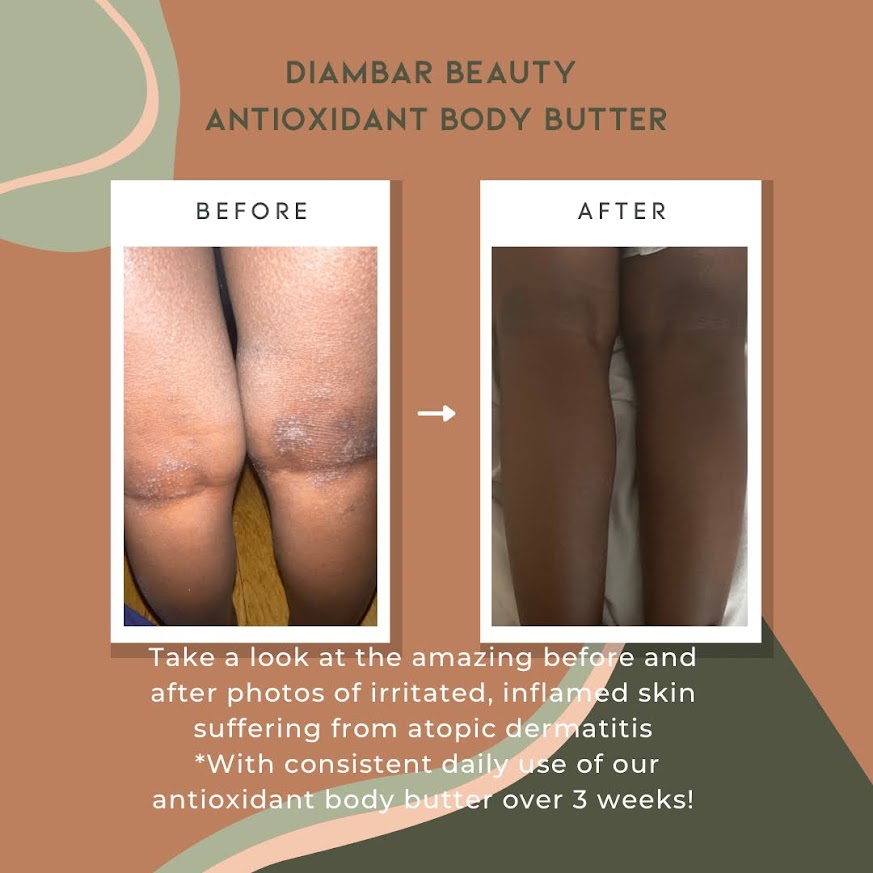 Antioxidant Body Butter